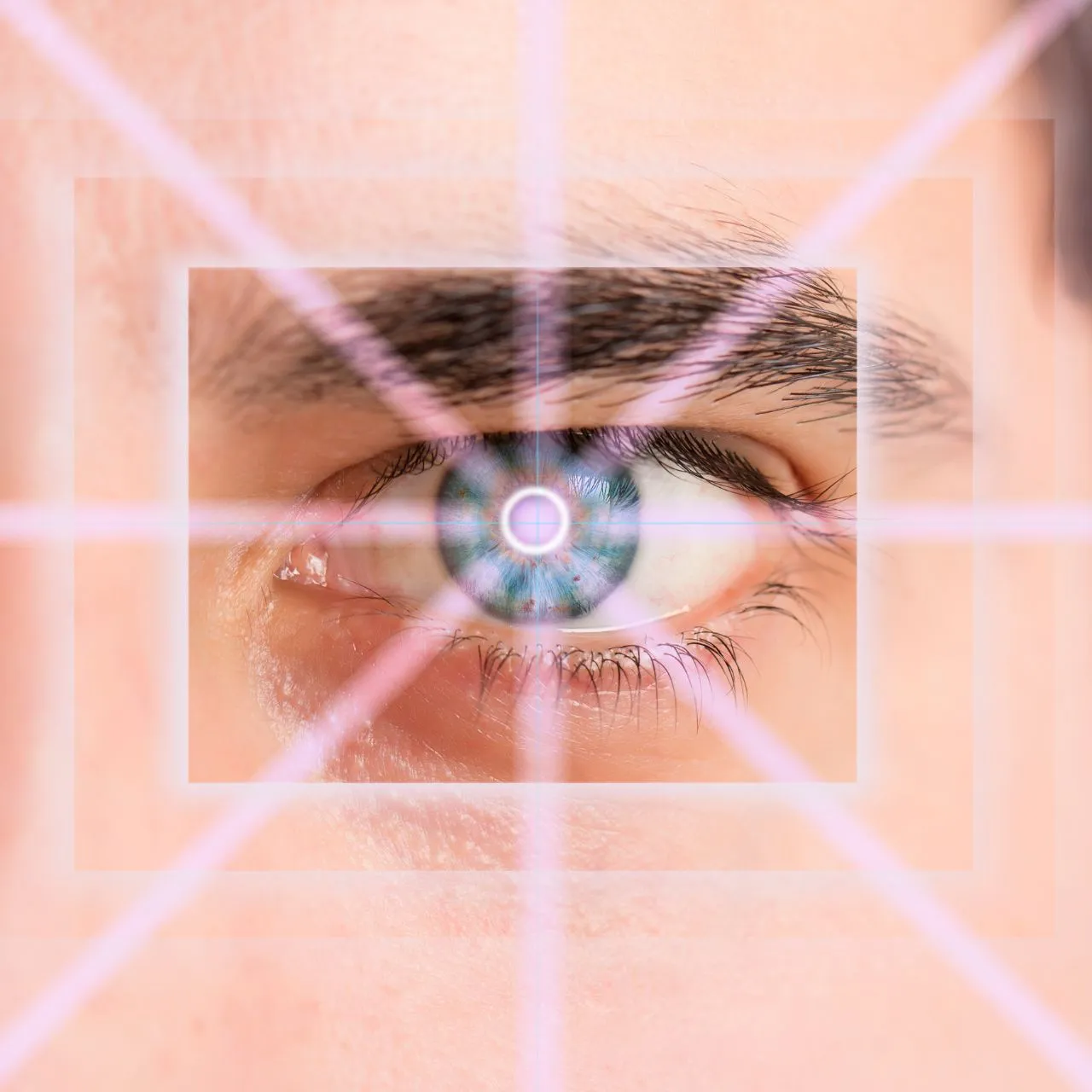 NV LASIK