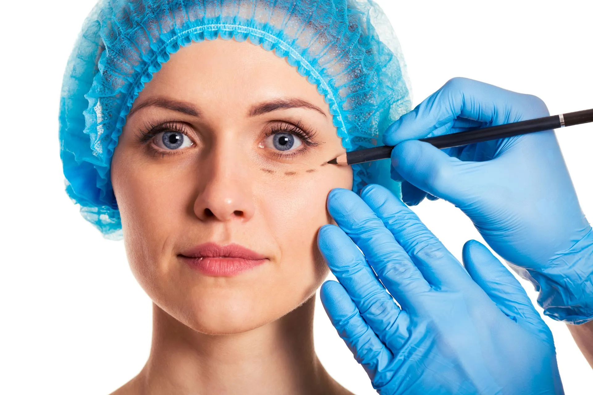 Blepharoplasty
