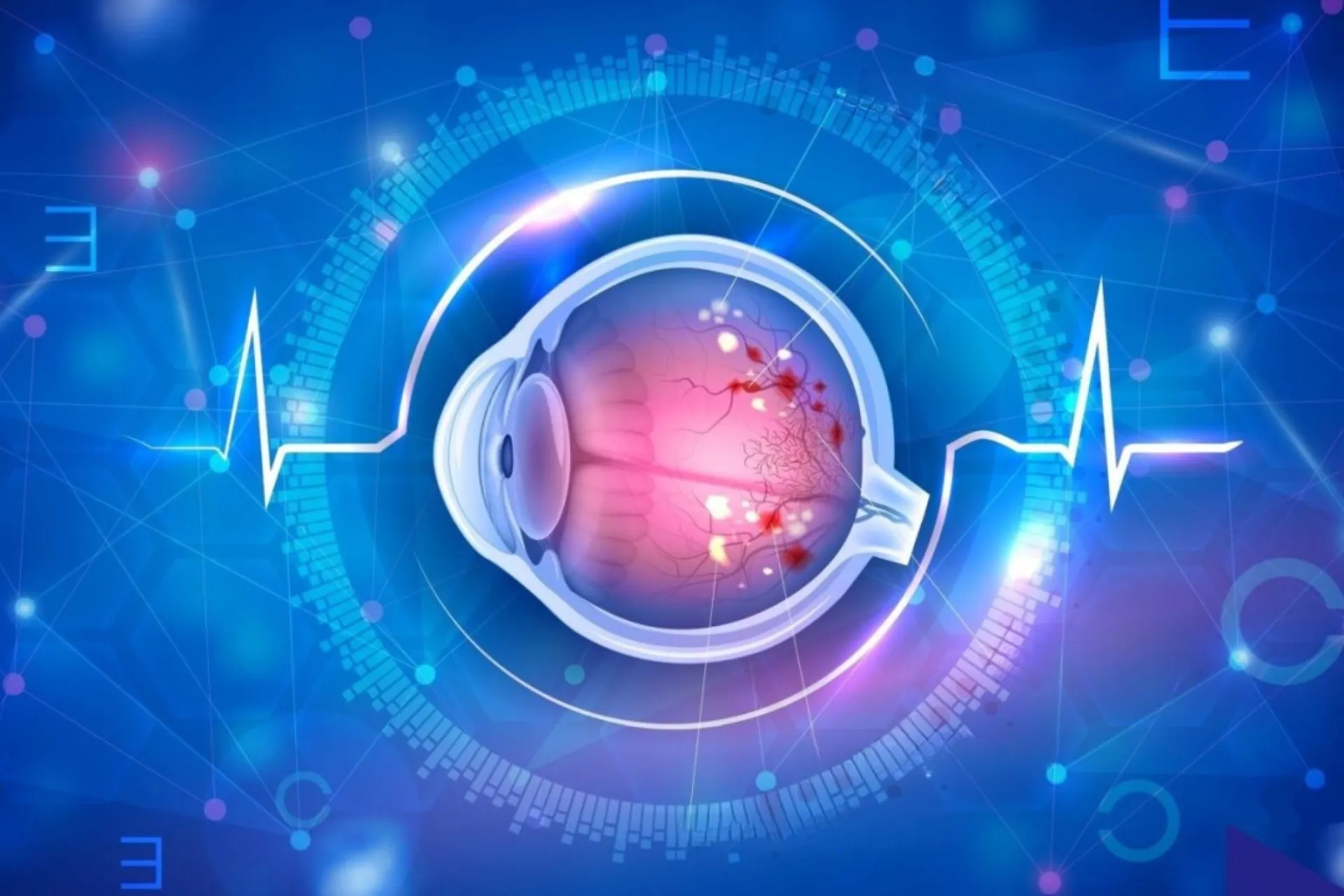 Diabetic Retinopathy Treatment