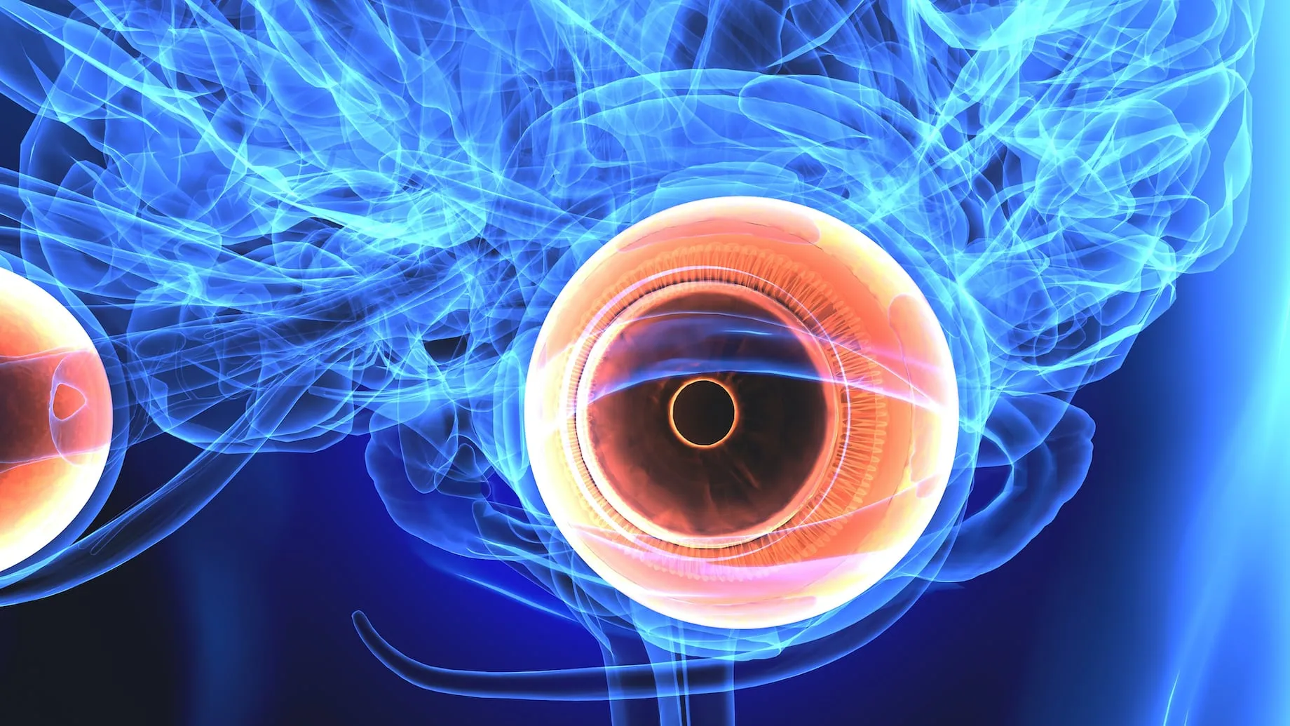 Optic Neuritis Treatment