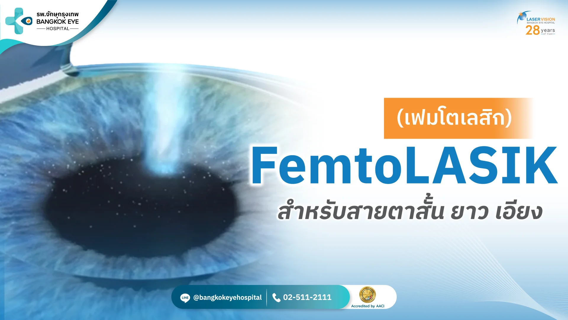 FemtoLASIK FemtoLASIK