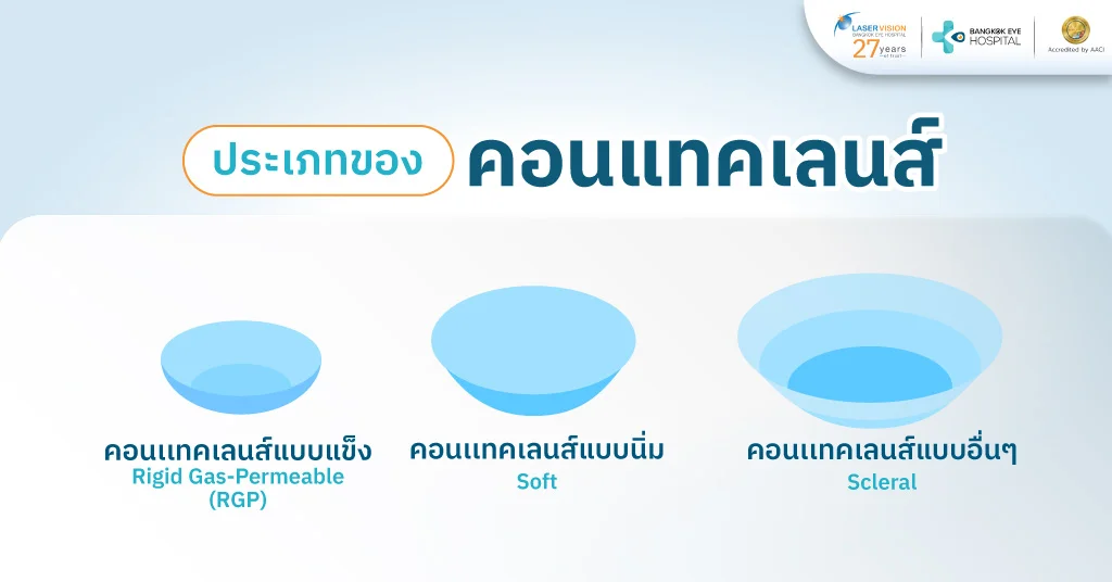 ประเภทของคอนเเทคเลนส์