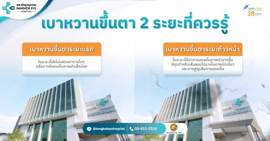 อาการเบาหวานขึ้นตา เบาหวานขึ้นตา 2 ระยะ