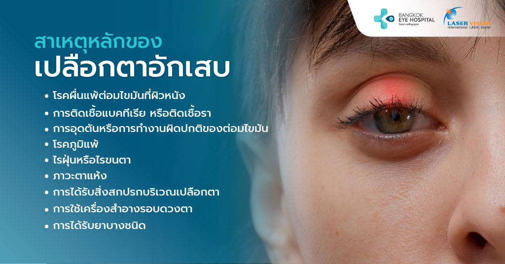สาเหตุหลักของเปลือกตาอักเสบมีอะไรบ้าง?