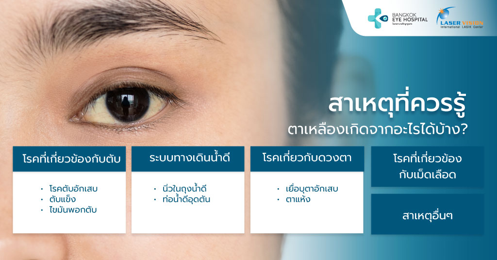 สาเหตุที่ควรรู้ ตาเหลืองเกิดจากอะไรได้บ้าง?