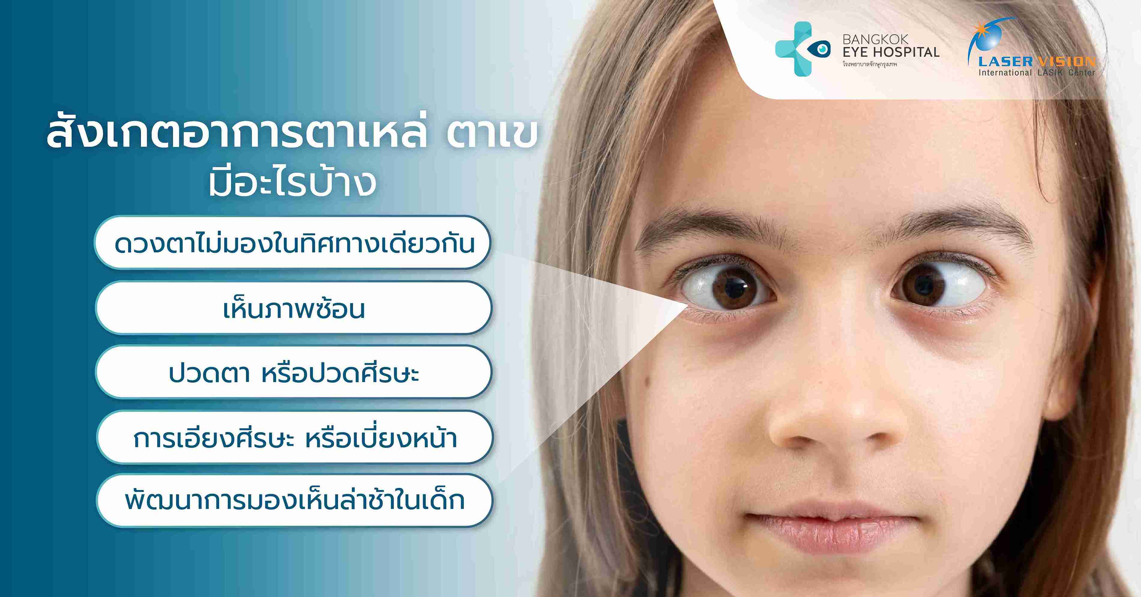 สังเกตอาการตาเหล่ ตาเข มีอะไรบ้าง