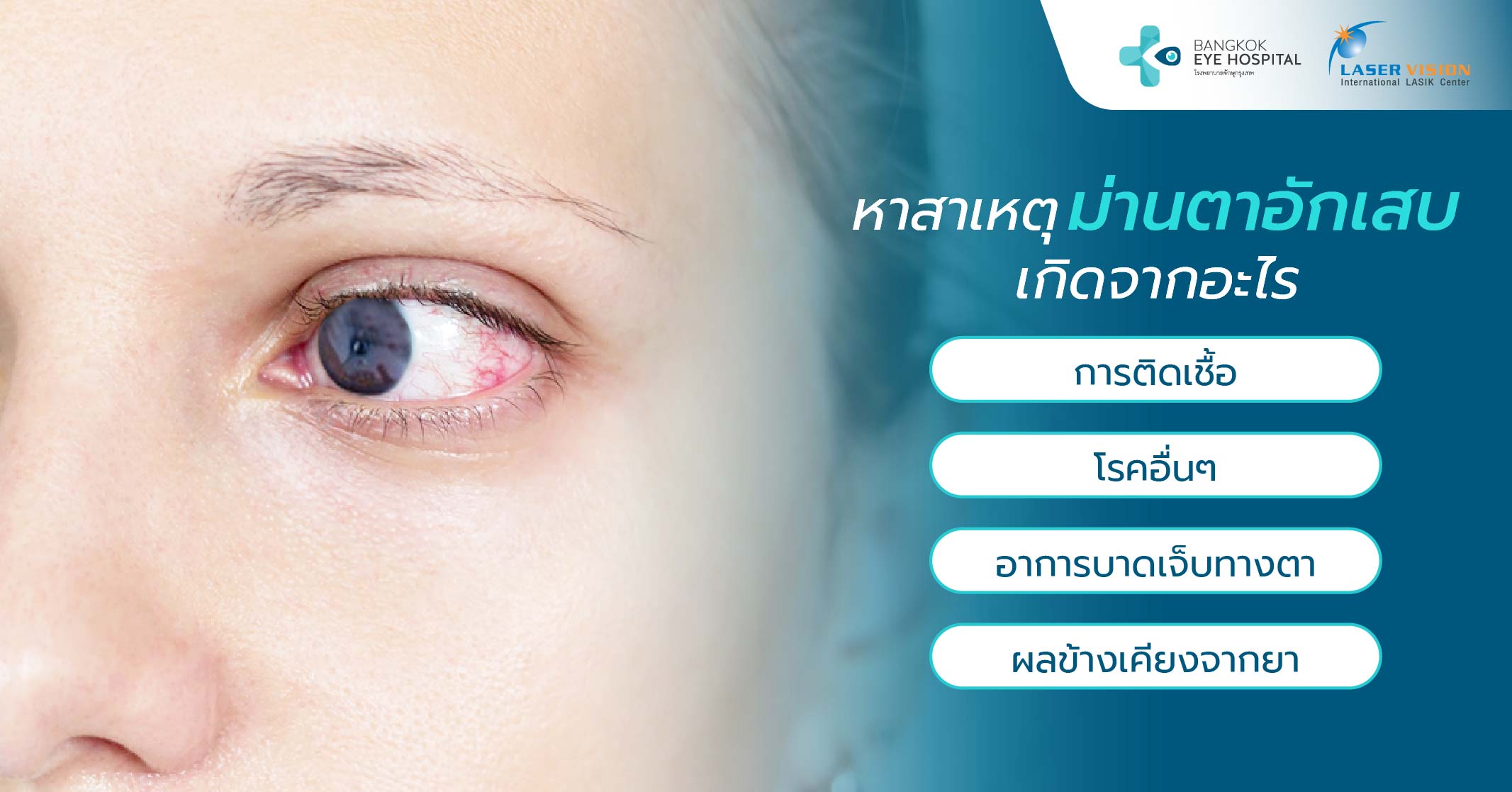 ประเภทของอาการม่านตาอักเสบ