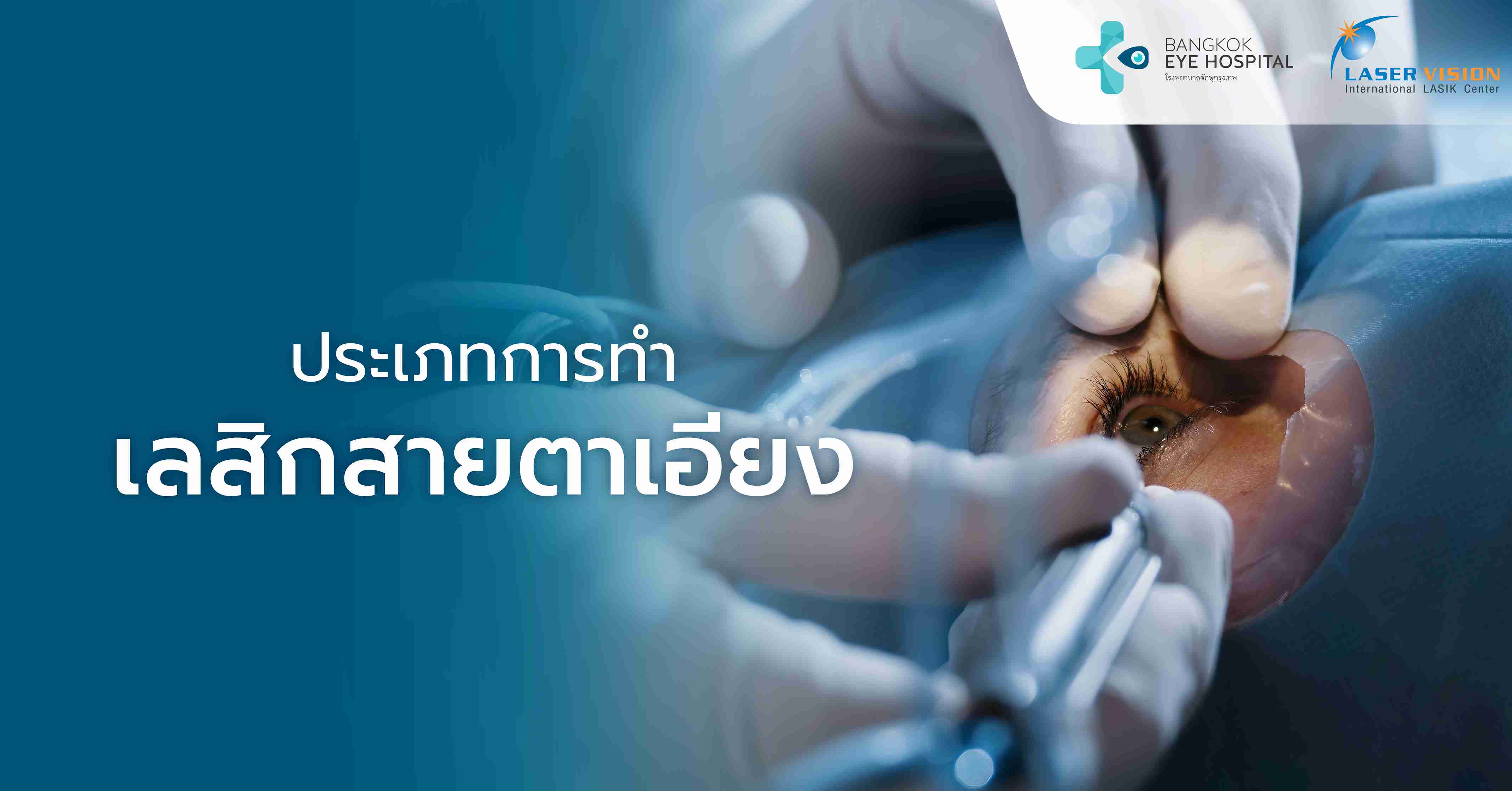 ประเภทการทำเลสิกสายตาเอียง และการแก้ไขอื่นๆ