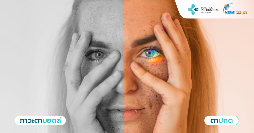  อาการของโรคตาบอดสีเป็นอย่างไร