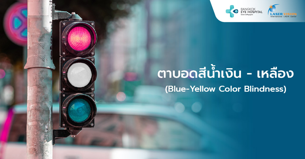2. ตาบอดสีน้ำเงิน - เหลือง (Blue-Yellow Color Blindness)
