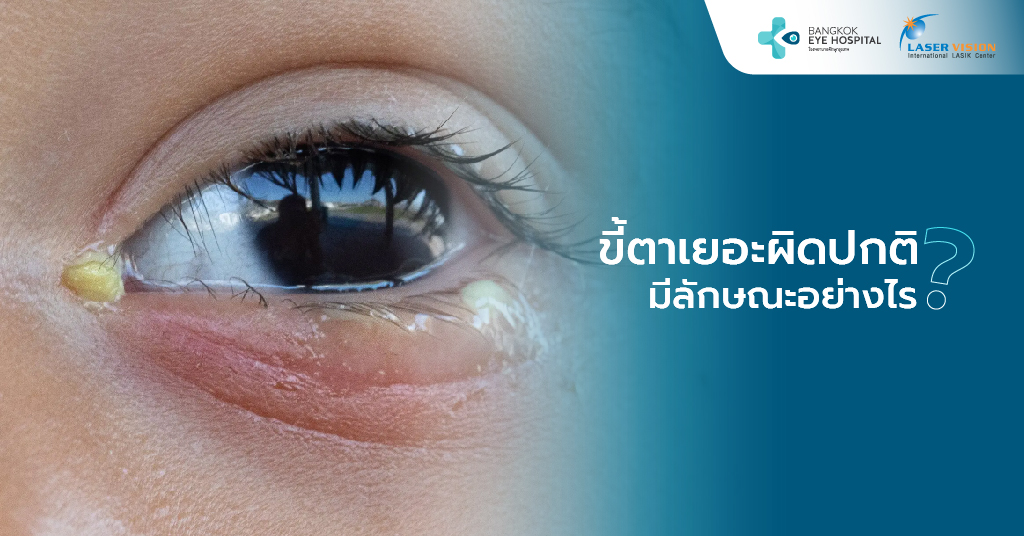 ขี้ตาเยอะผิดปกติ มีลักษณะอย่างไร