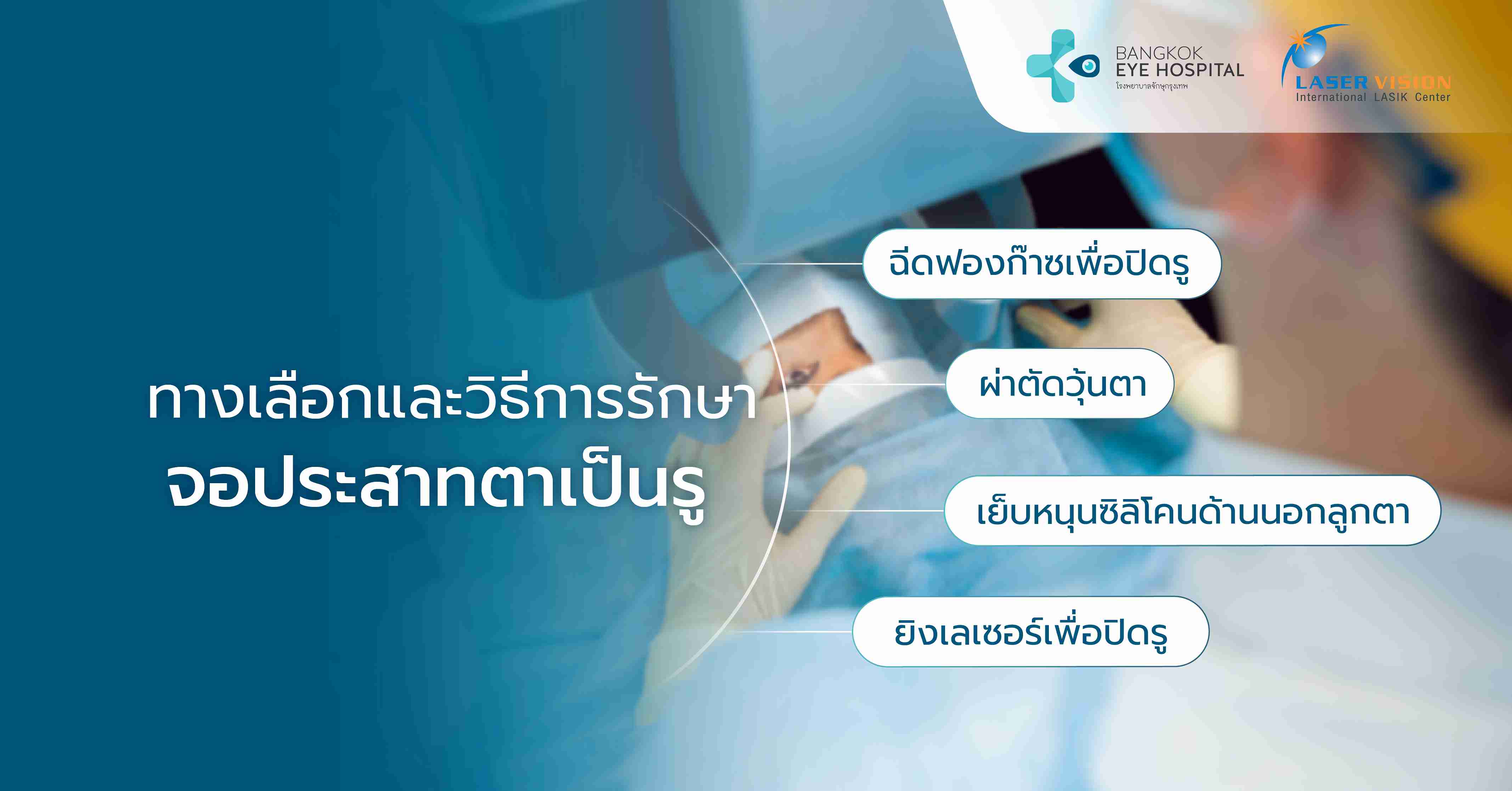 ทางเลือกและวิธีการรักษาจอประสาทตาเป็นรู