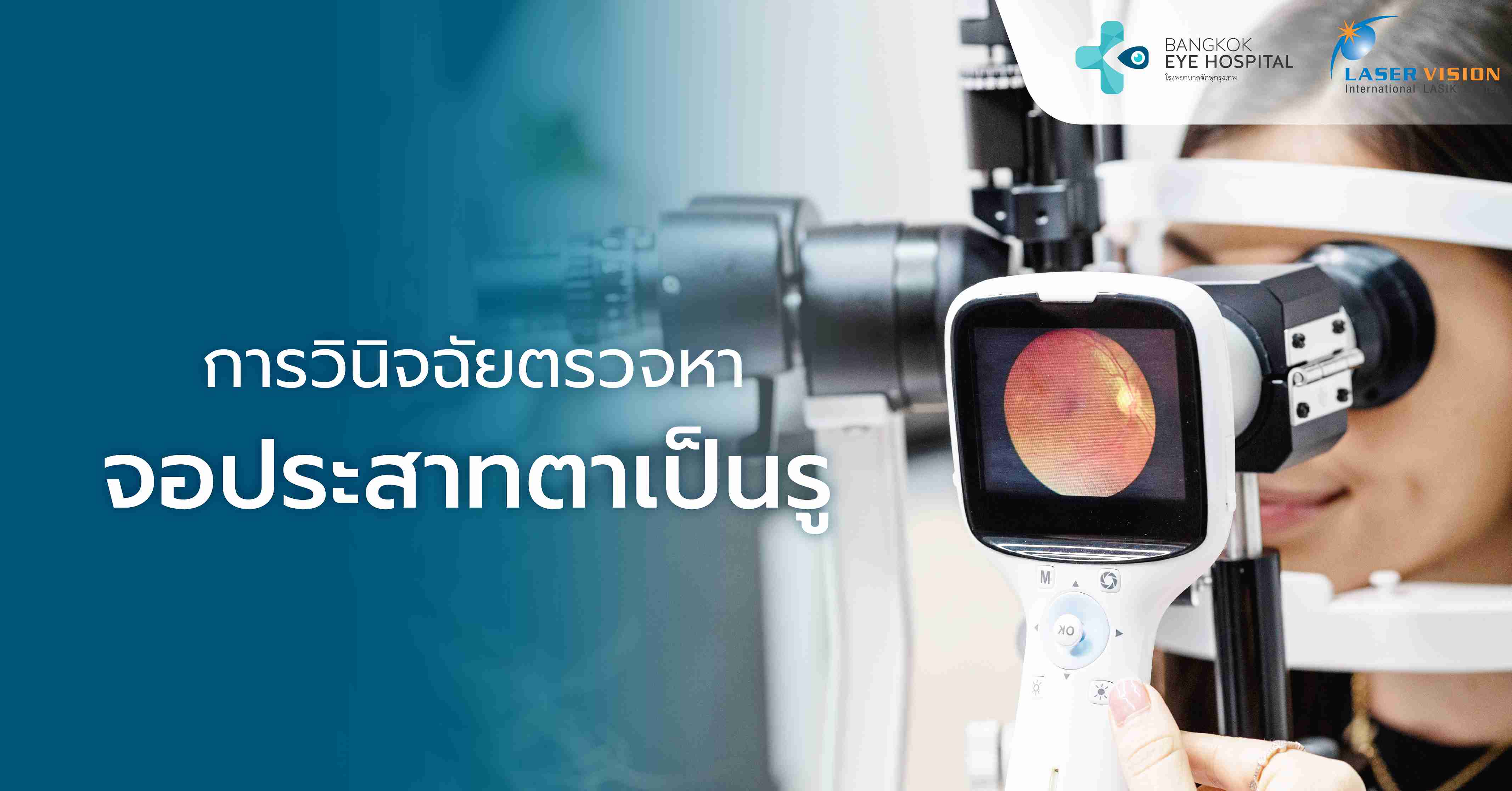 การวินิจฉัยตรวจหาจอประสาทตาเป็นรู