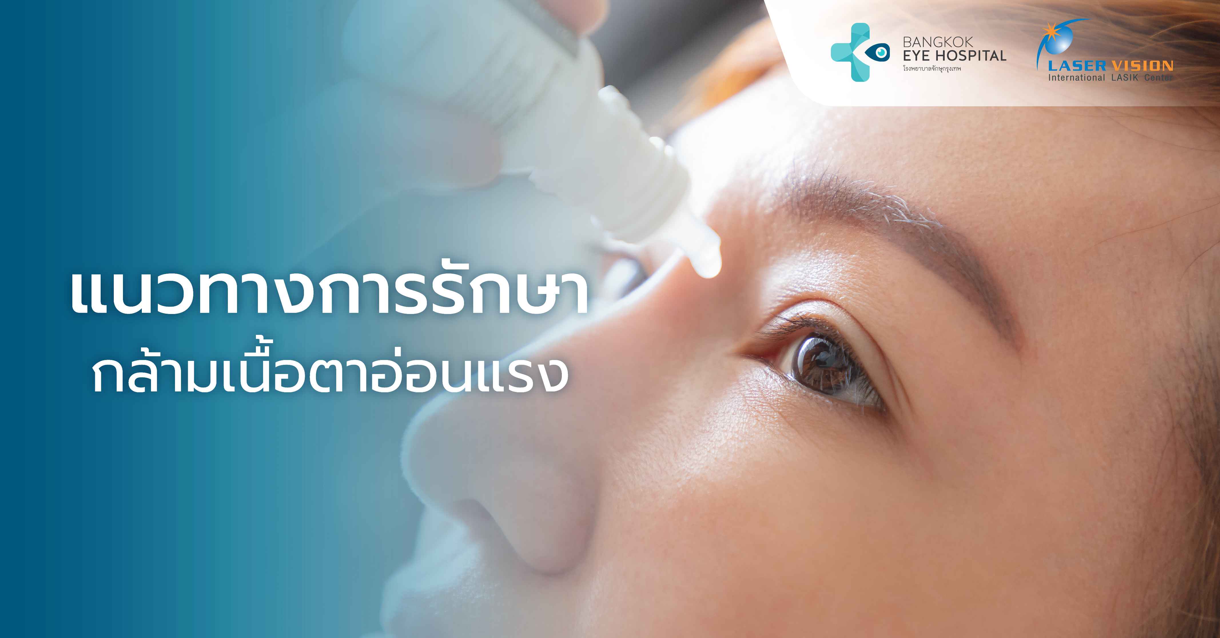 แนวทางการรักษากล้ามเนื้อตาอ่อนแรง