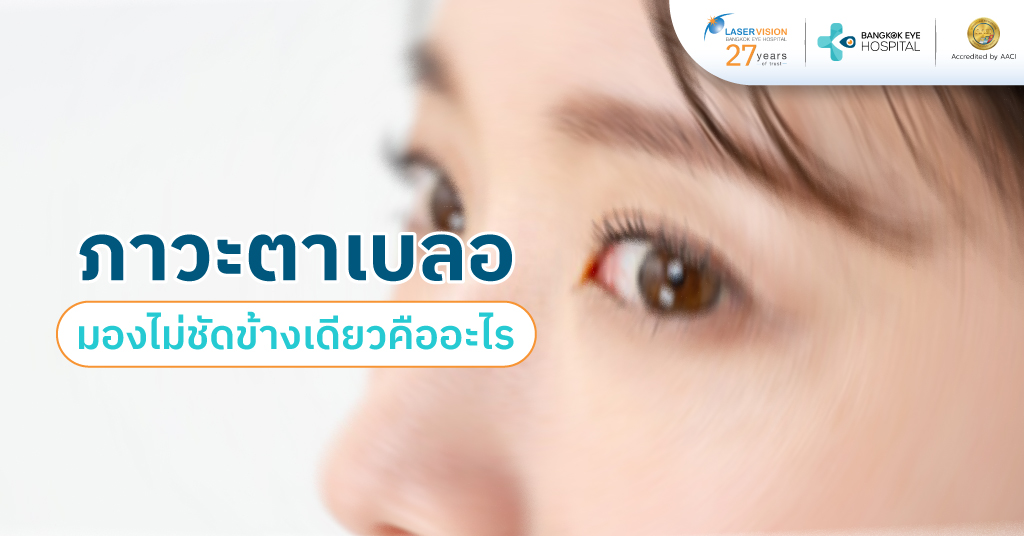 ภาวะตาเบลอ มองไม่ชัดข้างเดียวคืออะไร