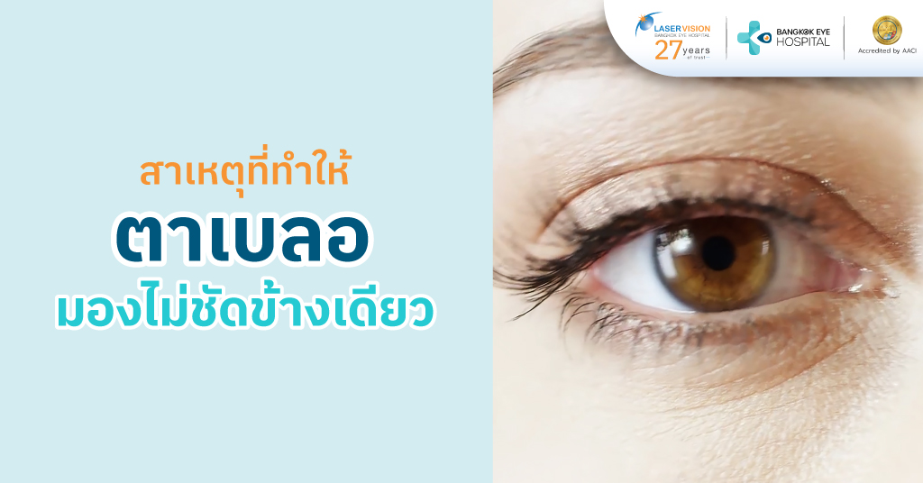 สาเหตุที่ทำให้ตาเบลอ มองไม่ชัดข้างเดียว