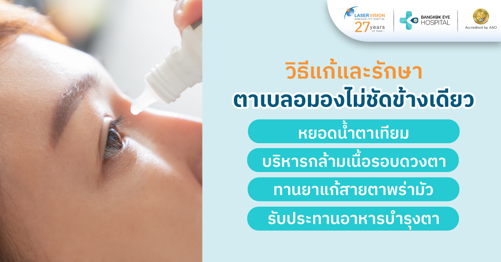 วิธีแก้และรักษาตาเบลอมองไม่ชัดข้างเดียว