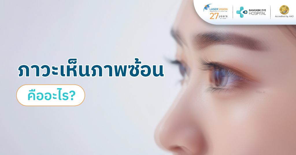 ภาวะเห็นภาพซ้อนคืออะไร? ภาวะเห็นภาพซ้อนคืออะไร?