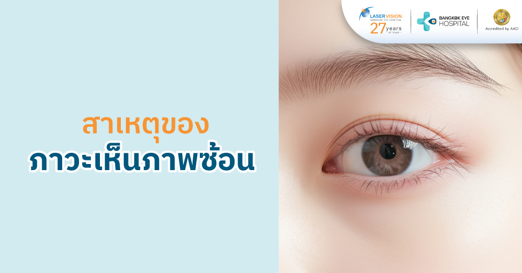 สาเหตุของภาวะเห็นภาพซ้อน สาเหตุของภาวะเห็นภาพซ้อน