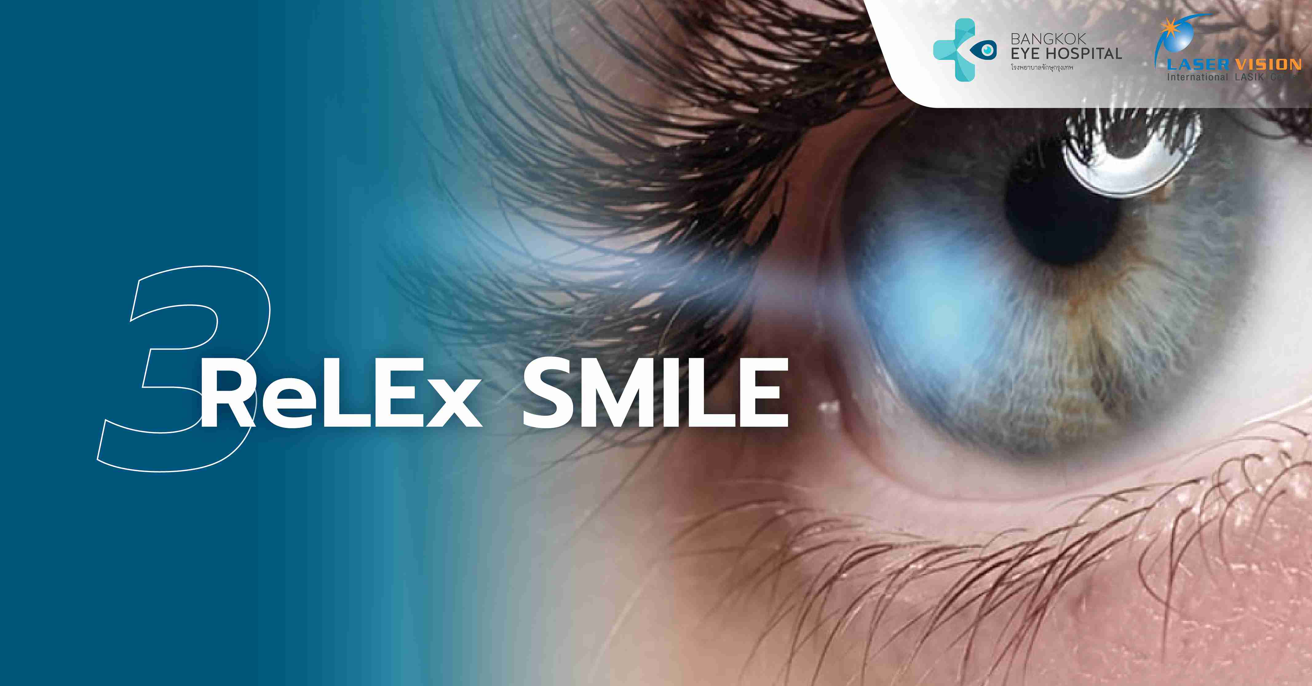 ReLEx SMILE (สำหรับสายตาสั้นและเอียงเท่านั้น)