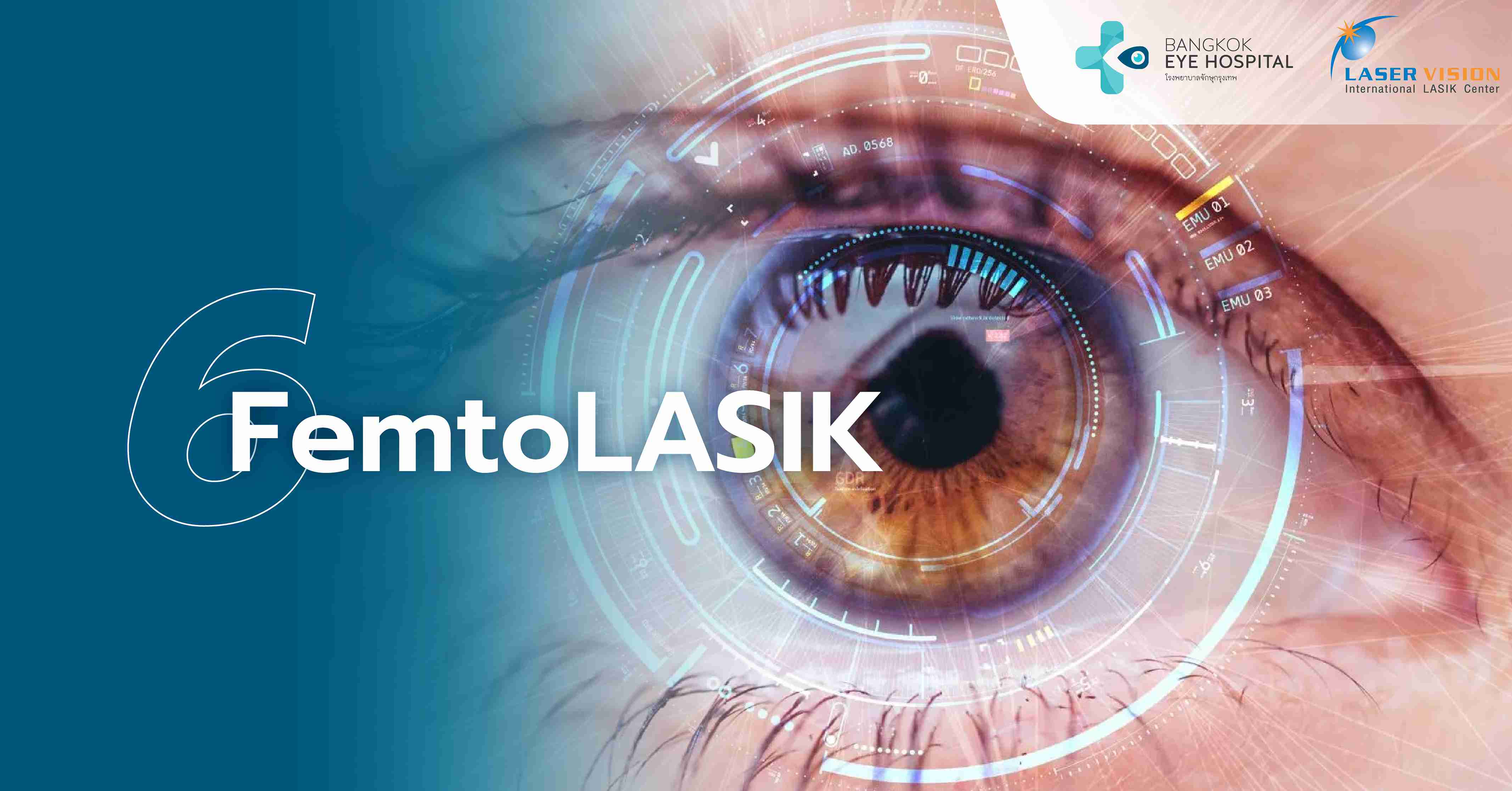  FemtoLASIK (สำหรับสายตาสั้น ยาว และเอียง)