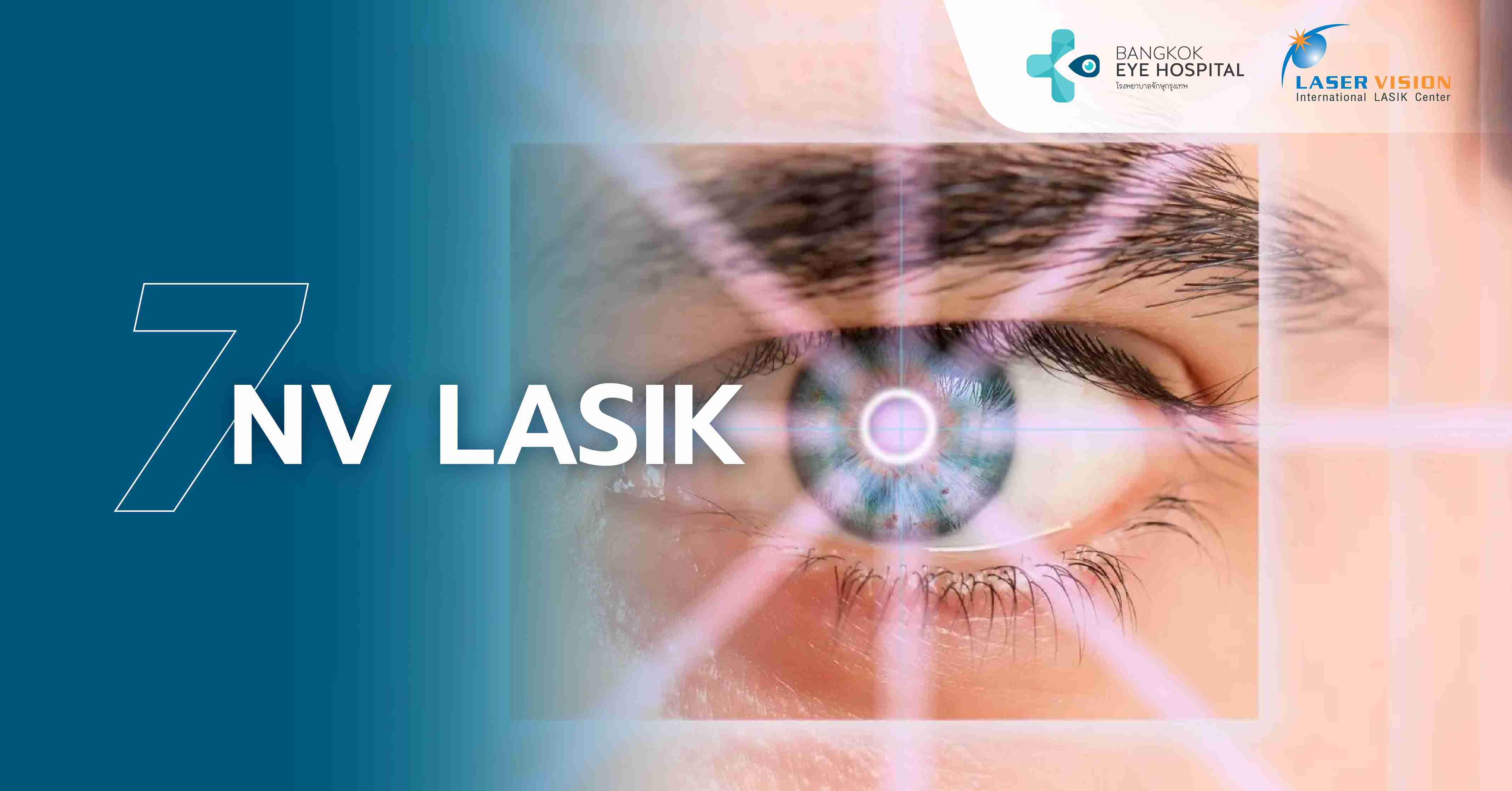 NV LASIK (สำหรับสายตายาวเท่านั้น)
