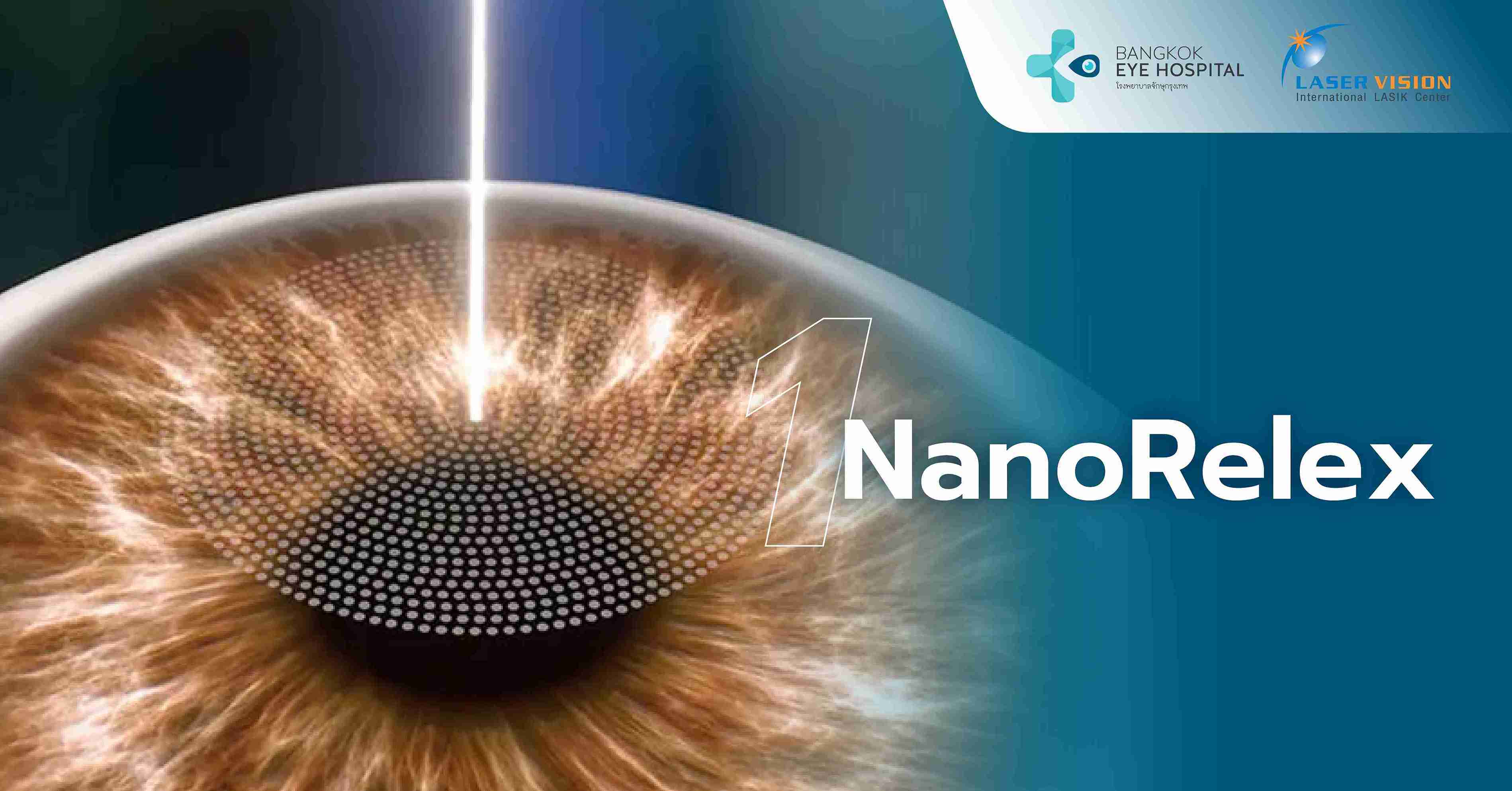 NanoRelex (สำหรับสายตาสั้นและเอียงเท่านั้น)