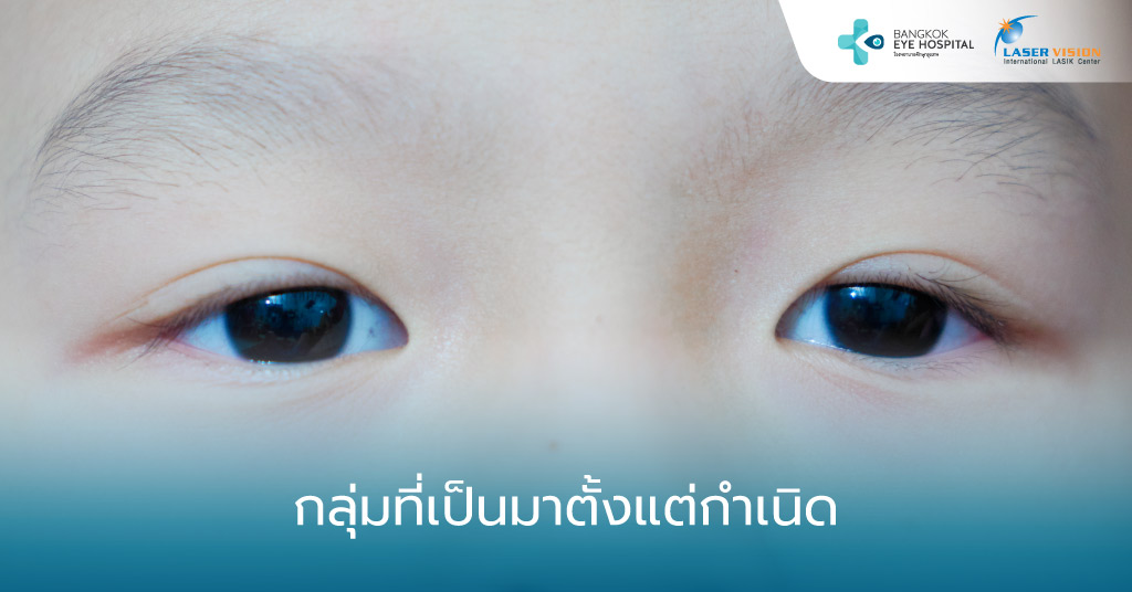 กลุ่มที่เป็นมาตั้งแต่กำเนิด