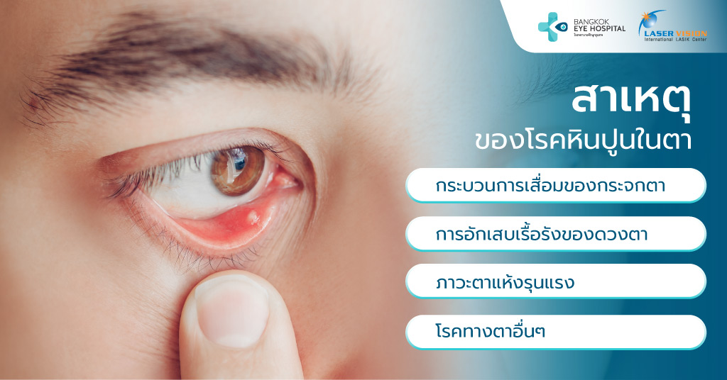 สาเหตุของโรคหินปูนในตา