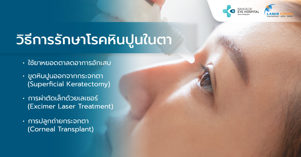 วิธีการรักษาโรคหินปูนในตา