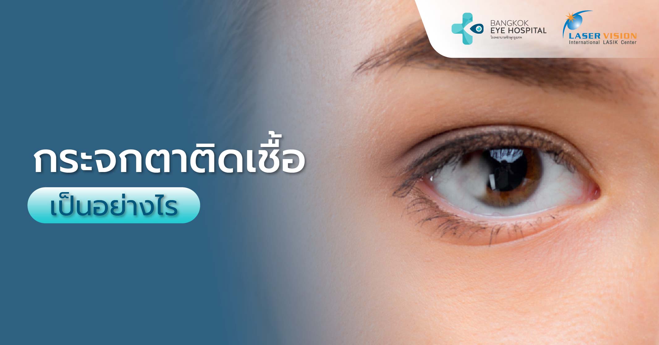 กระจกตาติดเชื้อเป็นอย่างไร