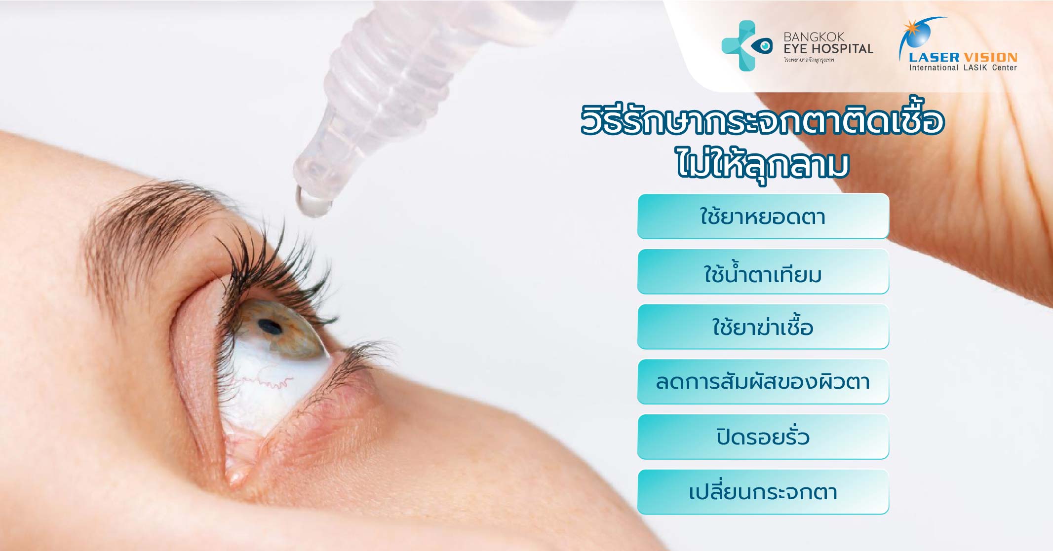 วิธีรักษากระจกตาติดเชื้อ ไม่ให้ลุกลาม