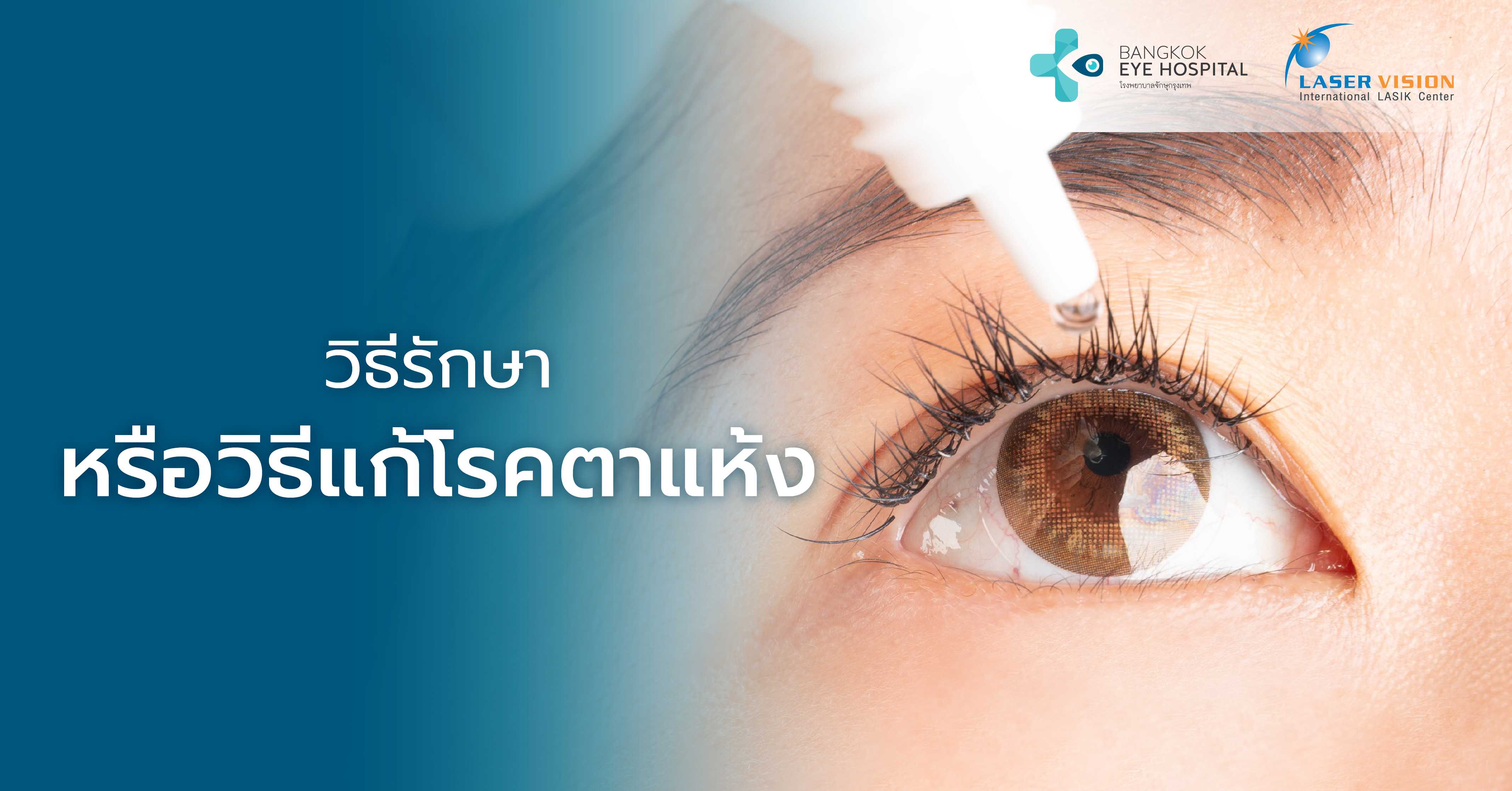 วิธีรักษาหรือวิธีแก้โรคตาแห้ง