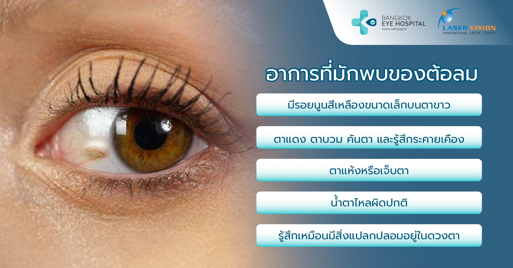 อาการที่มักพบของต้อลม