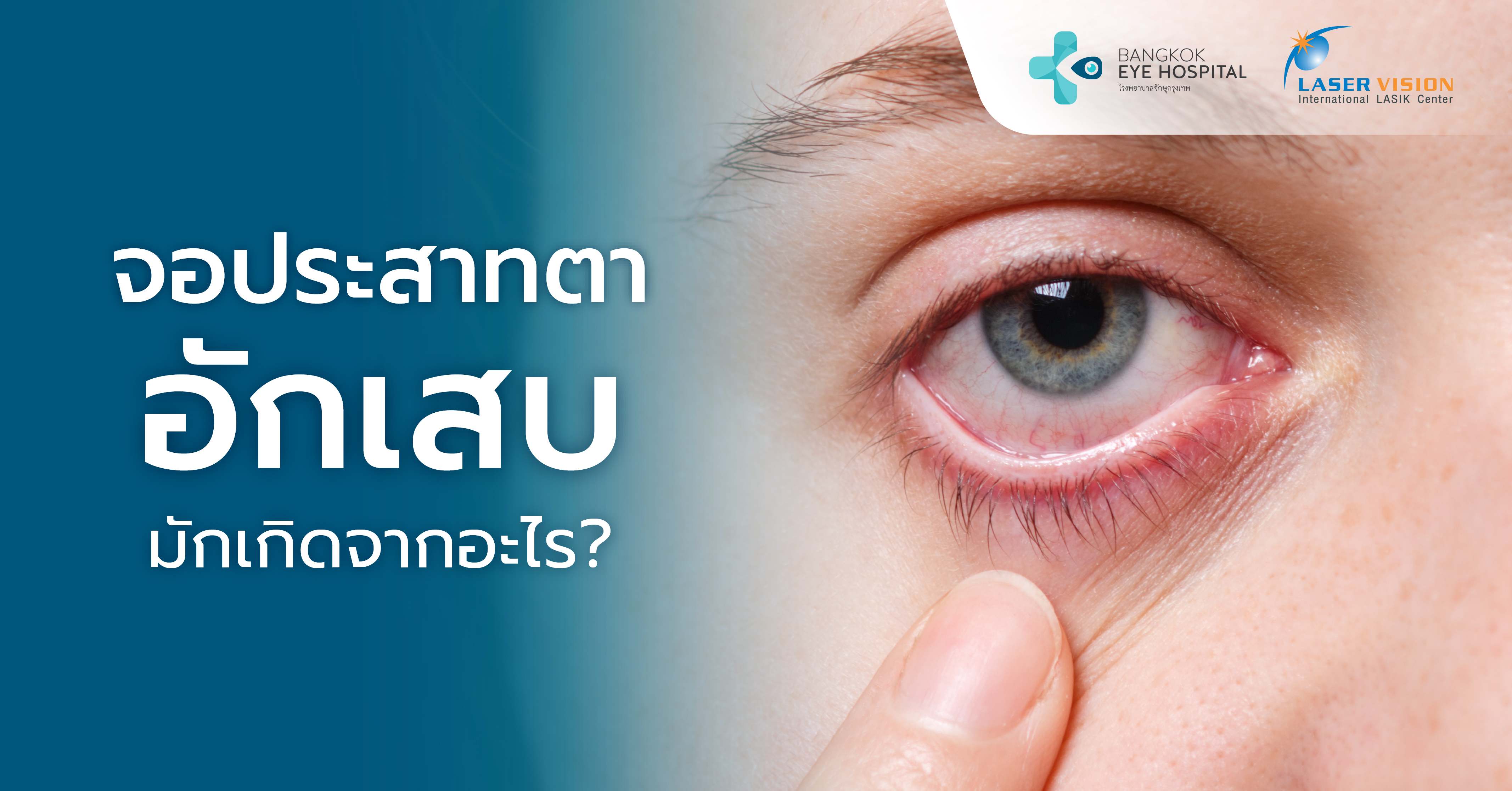 จอประสาทตาอักเสบมักเกิดจากอะไร?