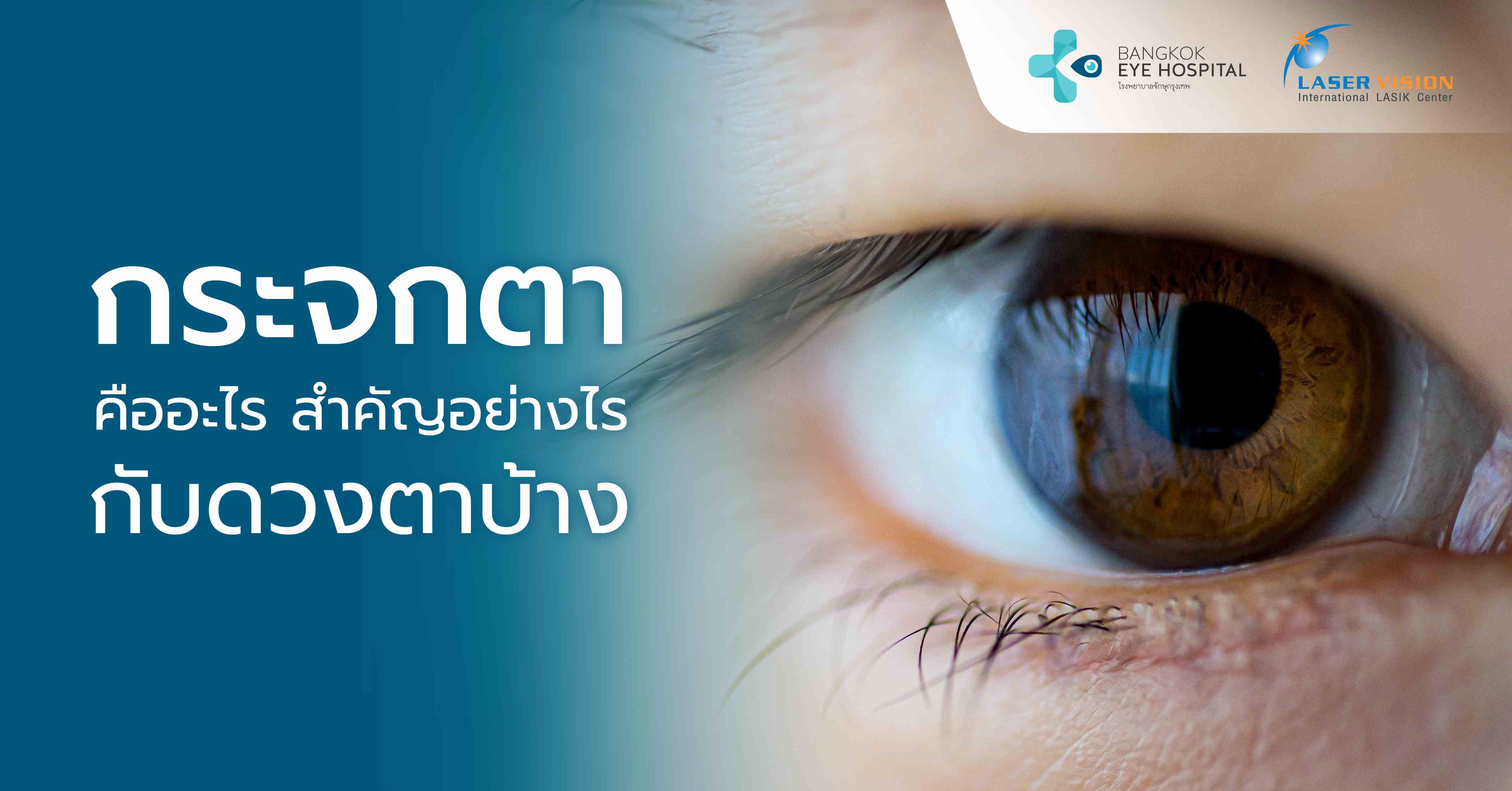 กระจกตาคืออะไร สำคัญอย่างไรกับดวงตาบ้าง
