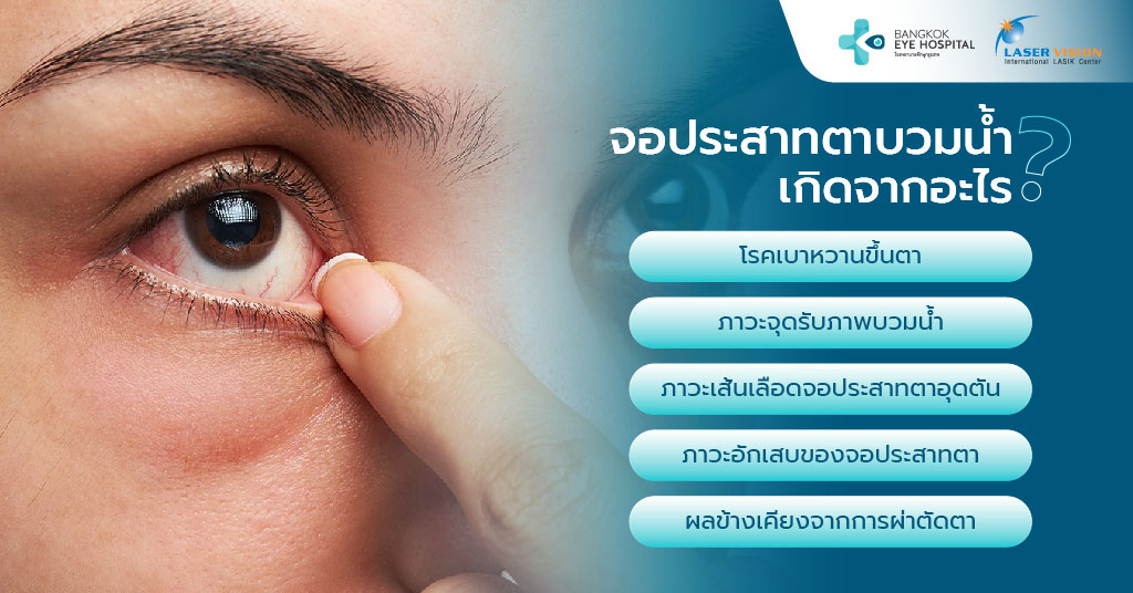 จอประสาทตาบวมน้ำเกิดจากอะไร?