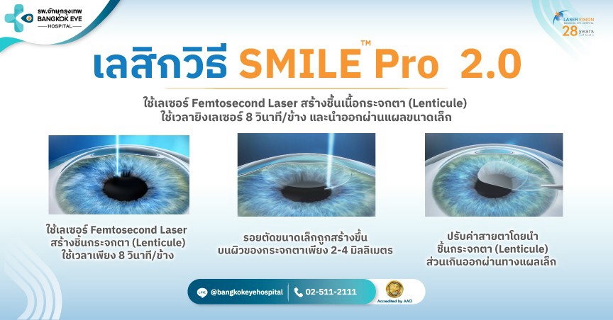 SMILE Pro 2.0 คืออะไร