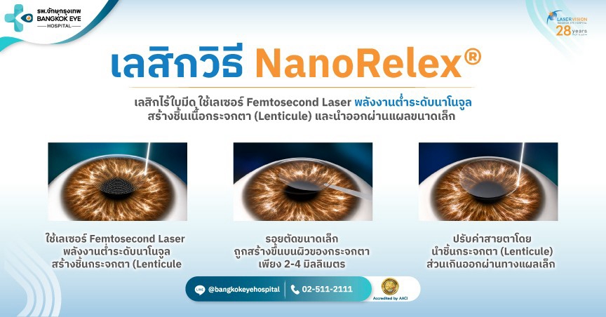 NanoRelex และ NanoLASIK คืออะไร