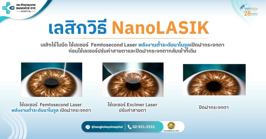 What are NanoRelex and NanoLASIK