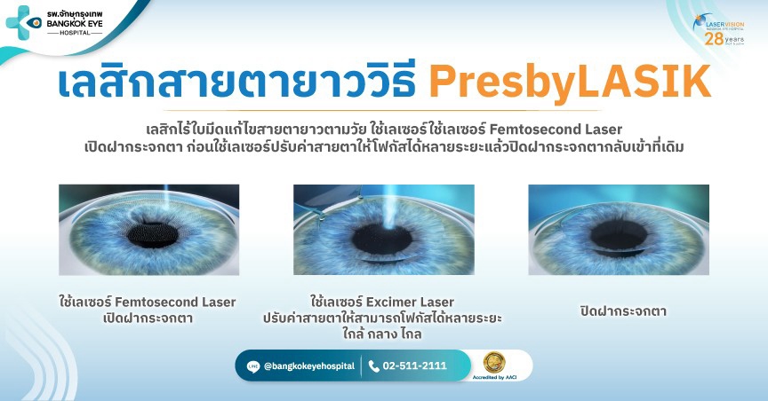 PresbyLASIK คืออะไร