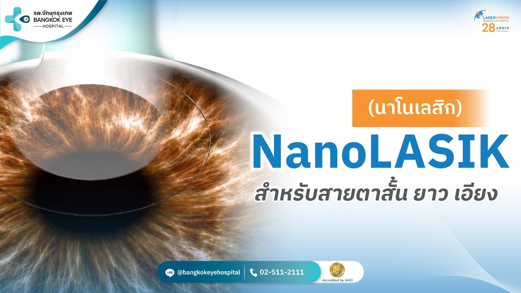 NanoLASIK NanoLASIK